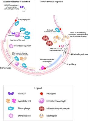 GM-CSF: Orchestrating the Pulmonary Response to Infection